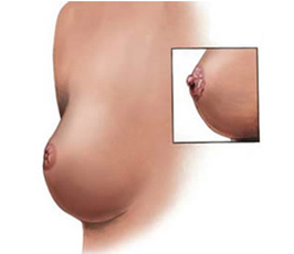 Nipple-Anatomy-Tunisia